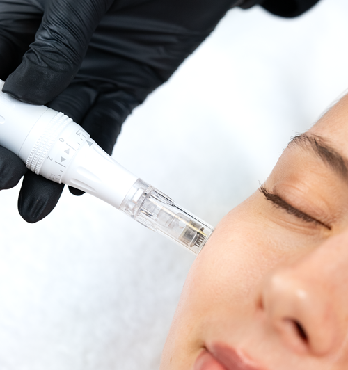 Collagen-Fadenlifting Behandlungen